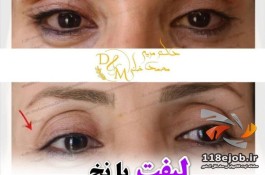  خدمات پوست و مو دکتر مریم محمد خانی در مشهد