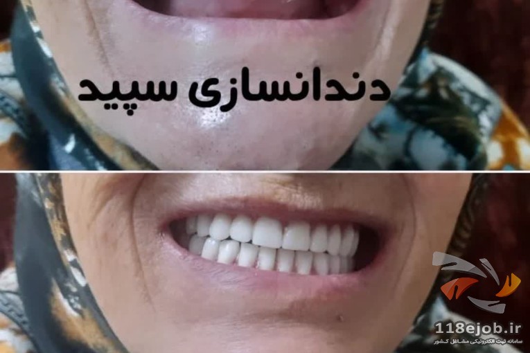 لابراتور دندانسازی سپید در لنگرود