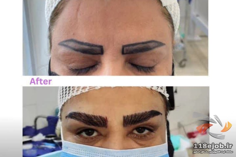کلینیک زیبایی و کاشت مو سیب در شیراز