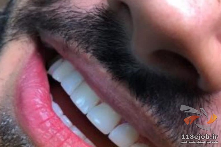 بهترین کلینیک دندانپزشکی در ساوه