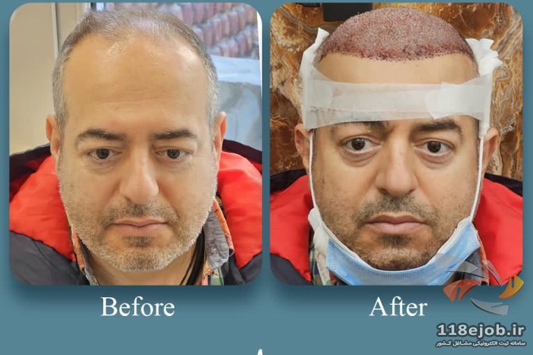کلینیک تخصصی پوست و مو آتریسا در شیراز