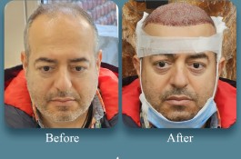 کلینیک تخصصی پوست و مو آتریسا در شیراز