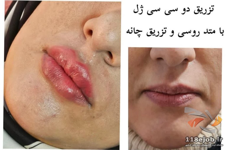 بهترین کلینیک پوست و مو و زیبایی در کرمانشاه