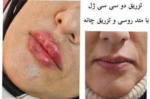 بهترین کلینیک پوست و مو و زیبایی در کرمانشاه