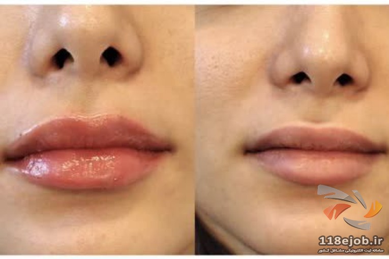 کلینیک پوست و زیبایی کیمیا در لاهیجان - بهترین کلینیک پوست و زیبایی در لاهیجان