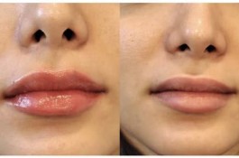 کلینیک پوست و زیبایی کیمیا در لاهیجان - بهترین کلینیک پوست و زیبایی در لاهیجان