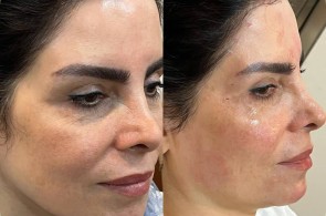 کلینیک پوست و زیبایی دکتر شهره محمدعلی پور در لنگرود - بهترین کلینیک پوست و زیبایی در لنگرود