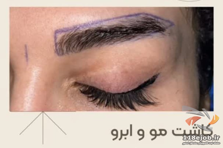 کاشت مو روستا در تهران