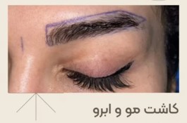 کاشت مو روستا در تهران