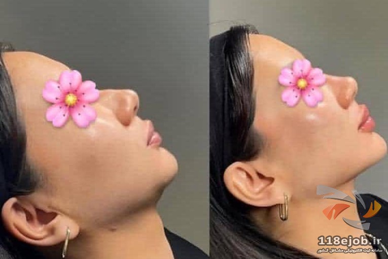 کلینیک زیبایی اِلا در کرج