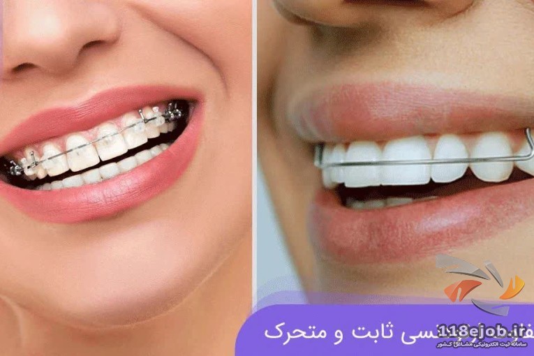 لابراتوار دندانسازی نگین در قزوین