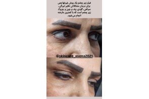 بهترین مرکز زیبایی در تبریز - مرکز زیبایی تخصصی آسنا در تبریز