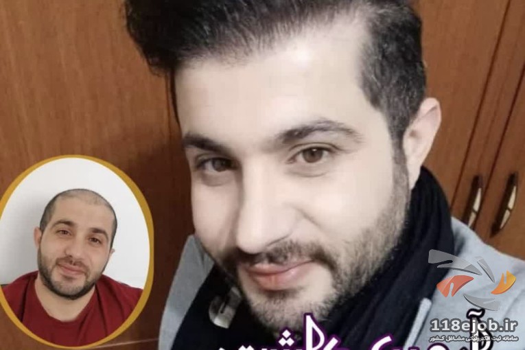 کلینیک تخصصی کاشت مو و زیبایی آروین کاشت در مهاباد