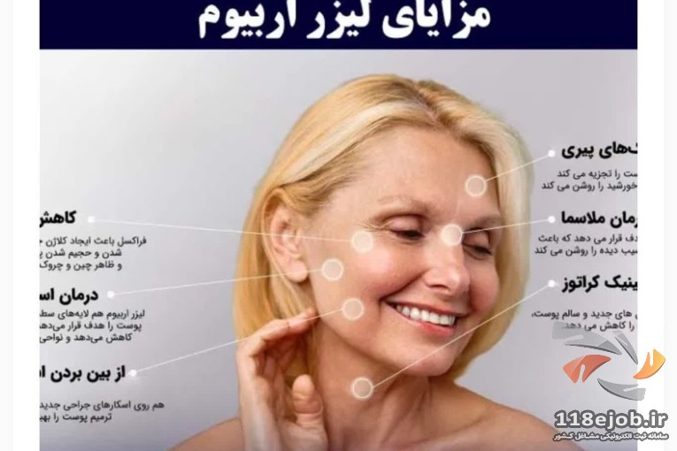 بهترین لیزر جوان سازی و درمان پوست در رشت - لیزر جوان سازی و درمان پوست ملکه در رشت