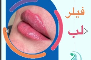 بهترین کلینیک زیبایی در هاشمیه مشهد - کلینیک زیبایی دکتر مهدی احمدی در هاشمیه مشهد