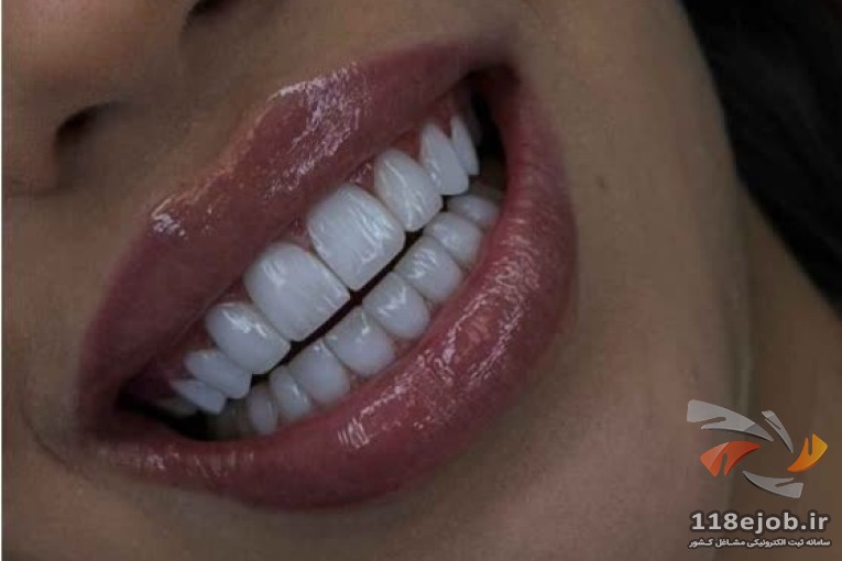 بهترین دندانسازی در قم - دکترای دندانسازی اکبری در قم
