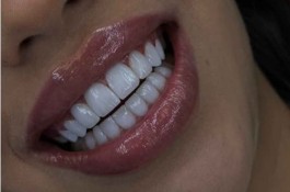 بهترین دندانسازی در قم - دکترای دندانسازی اکبری در قم