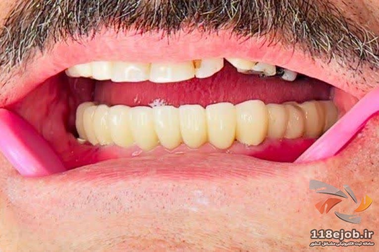 لابراتوار دندانسازی جهاندیده در رشت 